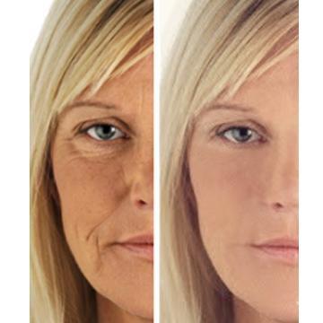 Age Perfect: Night Repair Cream + Vitamin C+ Serum Hyperion