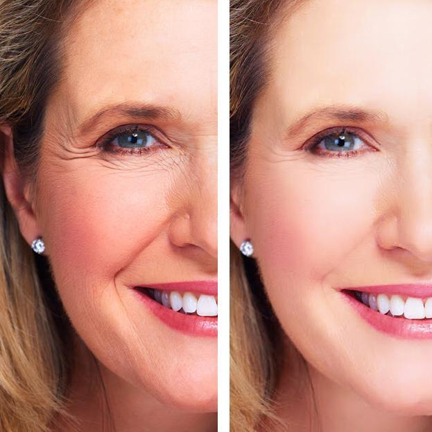 Age Perfect: Night Repair Cream + Vitamin C+ Serum Hyperion