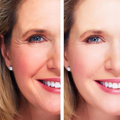 Age Perfect: Night Repair Cream + Vitamin C+ Serum Hyperion