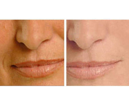 Age Perfect: Night Repair Cream + Vitamin C+ Serum Hyperion